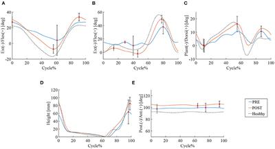 Analysis of Gait Motion Changes by Intervention Using Robot Suit Hybrid Assistive Limb (HAL) in Myelopathy Patients After Decompression Surgery for Ossification of Posterior Longitudinal Ligament